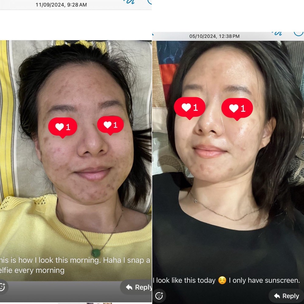 Customer selfie updates over a month, shared with consent
